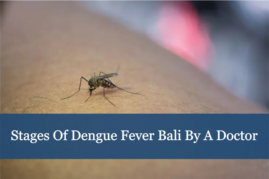 Stages of dengue fever Bali by a doctor-