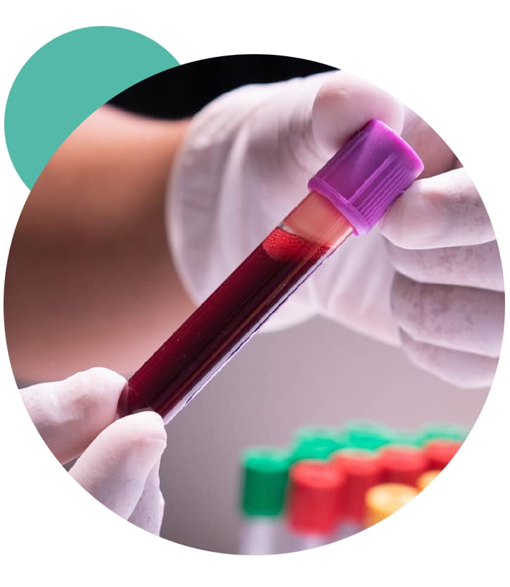 BLOOD TEST SALINE