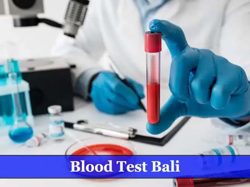 Blood Test Bali