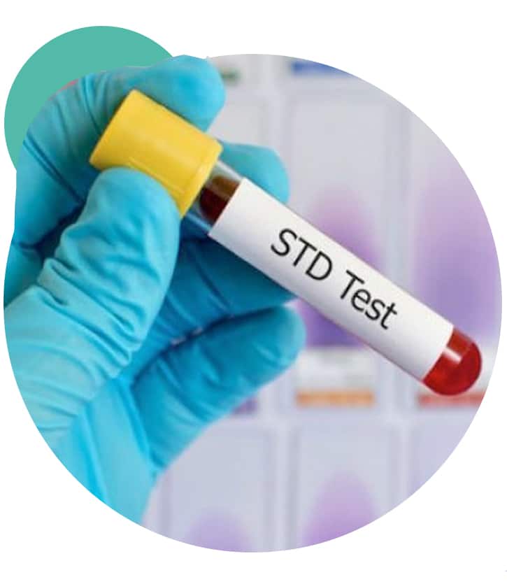 STD TEST SALINE