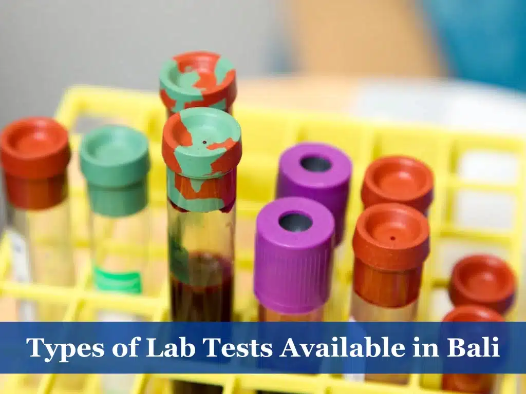 Types of Lab Tests Available in Bali