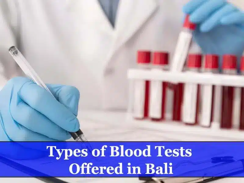 Types of blood tests offered in Bali
