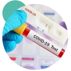 Covid-19 Antibody Quantitative