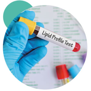 Lipid Profile Test