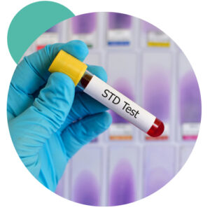 STD Test