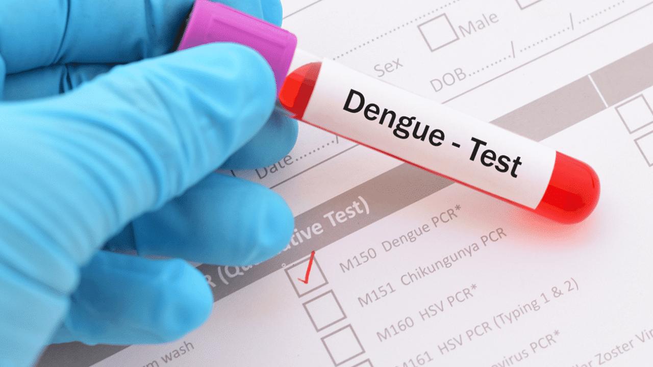 Dengue Test Bali