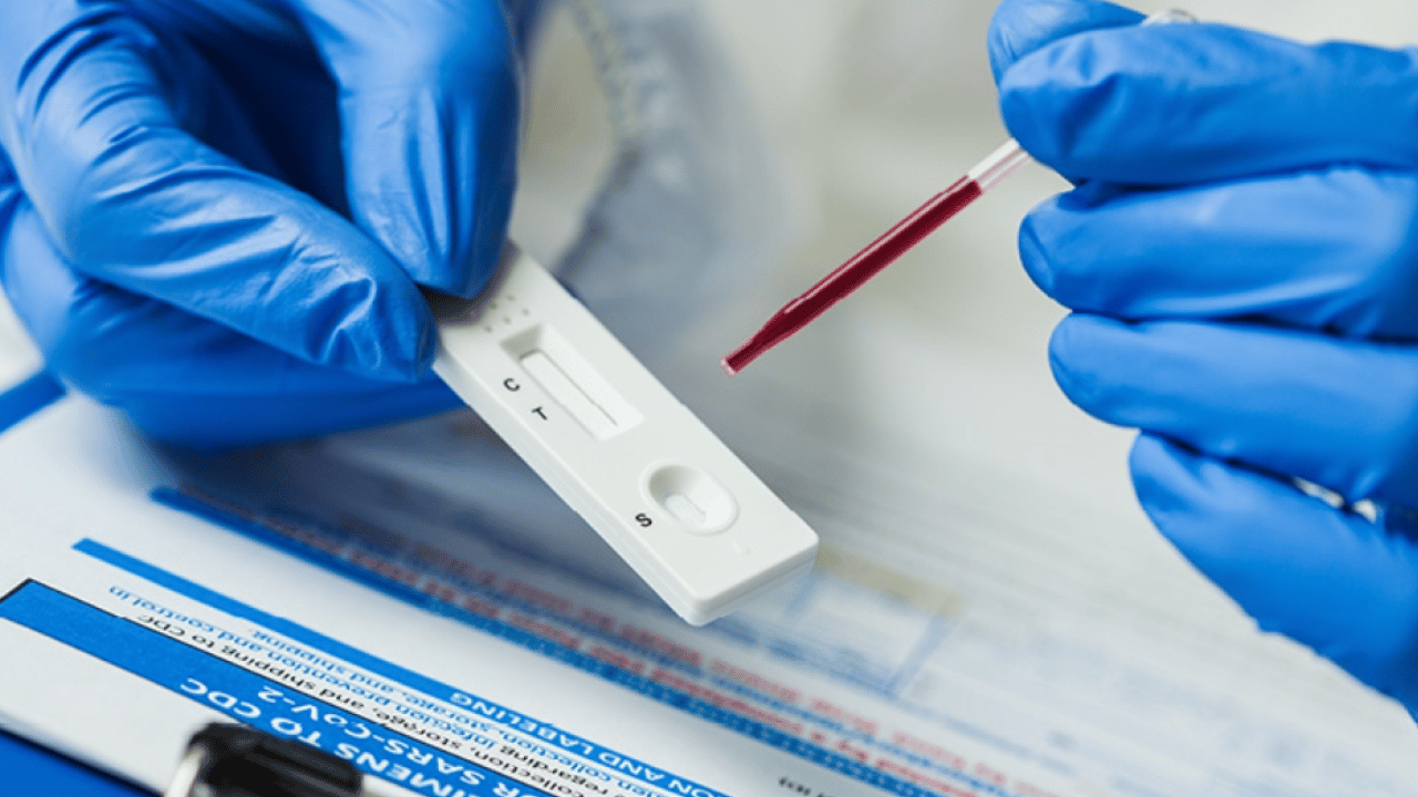 Why Dengue Tests Are Essential