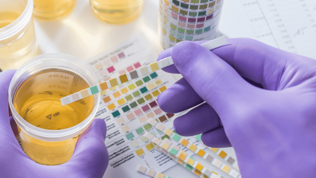Functions and Benefits of Urine and Feces Tests