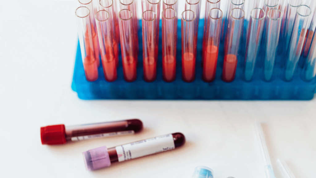 Step-by-Step Procedures for Urine and Feces Tests