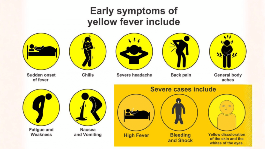 Symptoms of Yellow Fever
