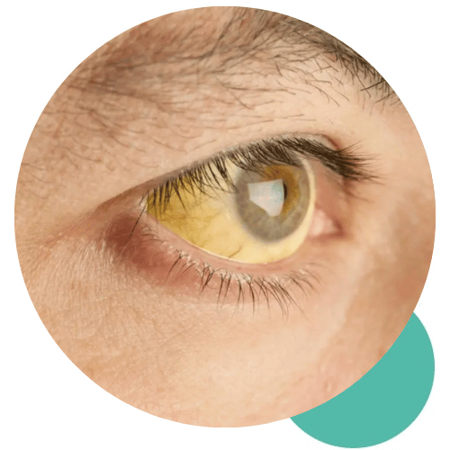 Yellow Fever Vaccine Bali - FI