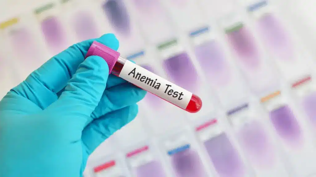 anemia-panel-test-at-saline-bali-clinic