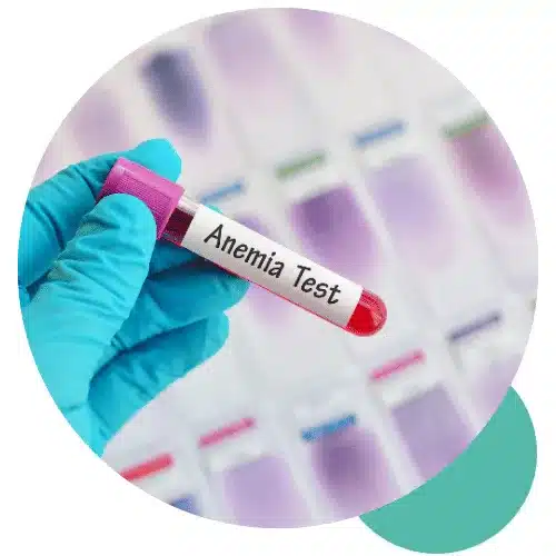 anemia-test-bali-fi