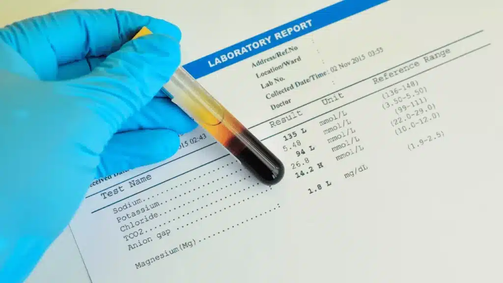 blood-electrolyte-tests-available-at-saline-bali-clinic