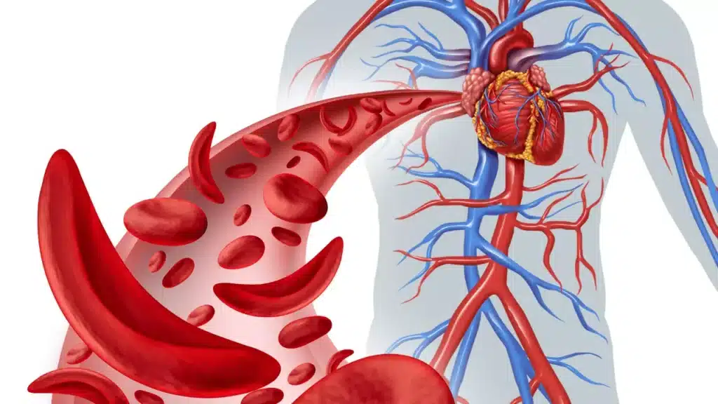 common-types-of-anemia