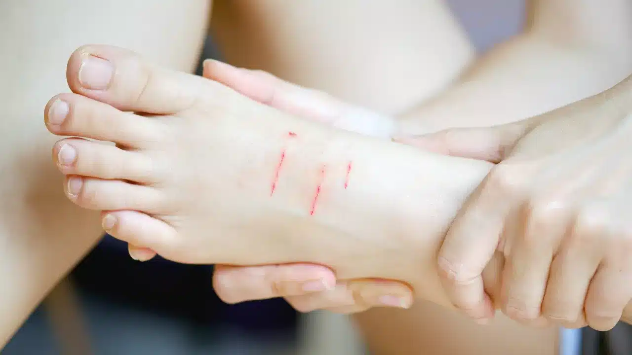 how-infection-happens