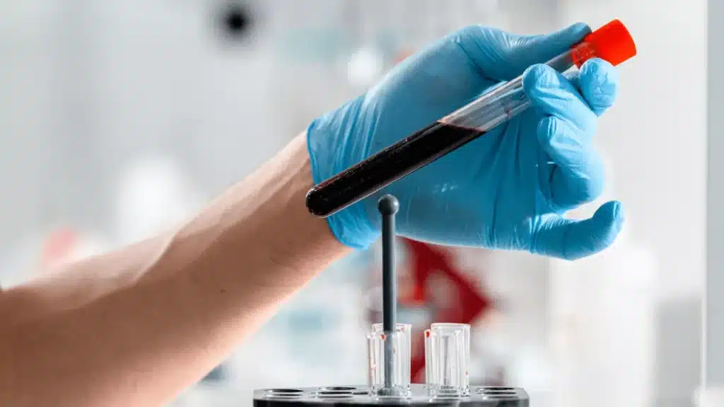 when-is-the-right-time-to-take-a-blood-electrolyte-test