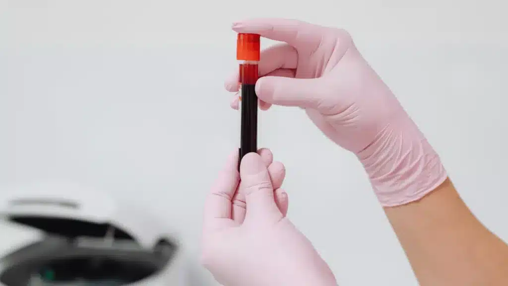 why-early-detection-of-anemia-is-important