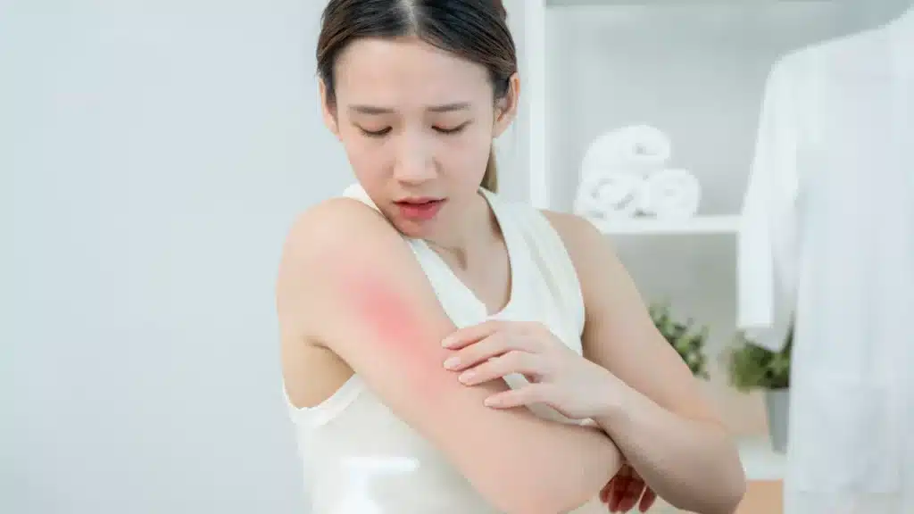 complications-of-chickenpox