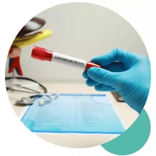 liver-function-test-fi