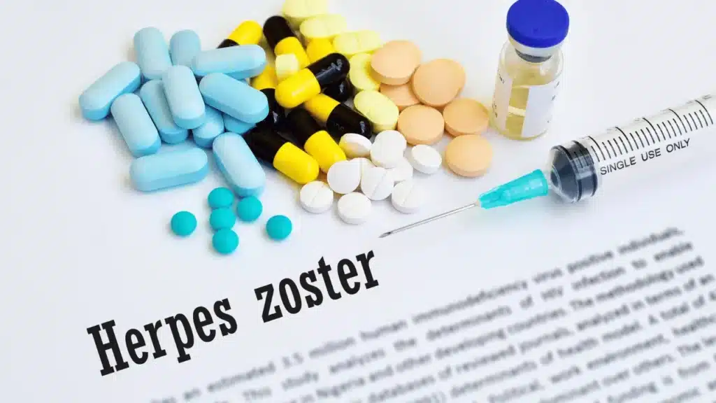 why-you-should-consider-the-herpes-zoster-vaccine
