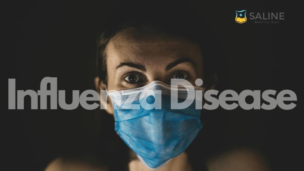 influenza-disease
