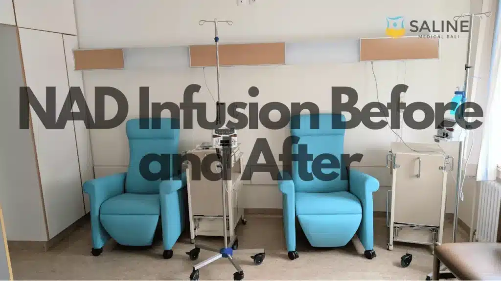 nad-infusion-before-and-after