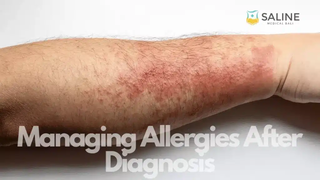 managing-allergies-after-diagnosis