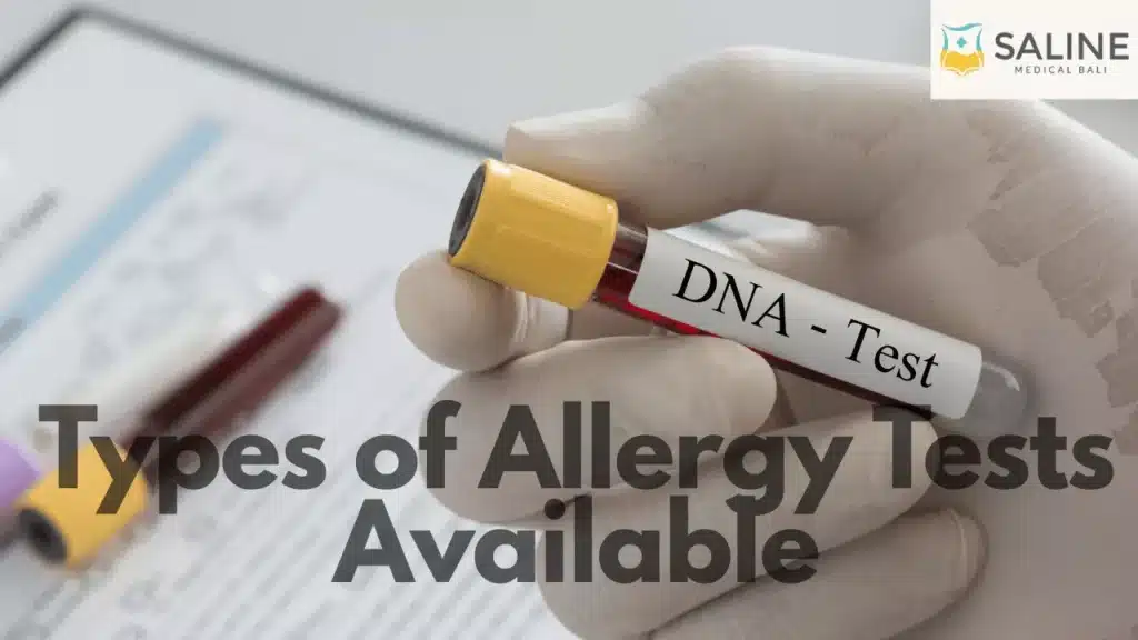 types-of-allergy-tests-available