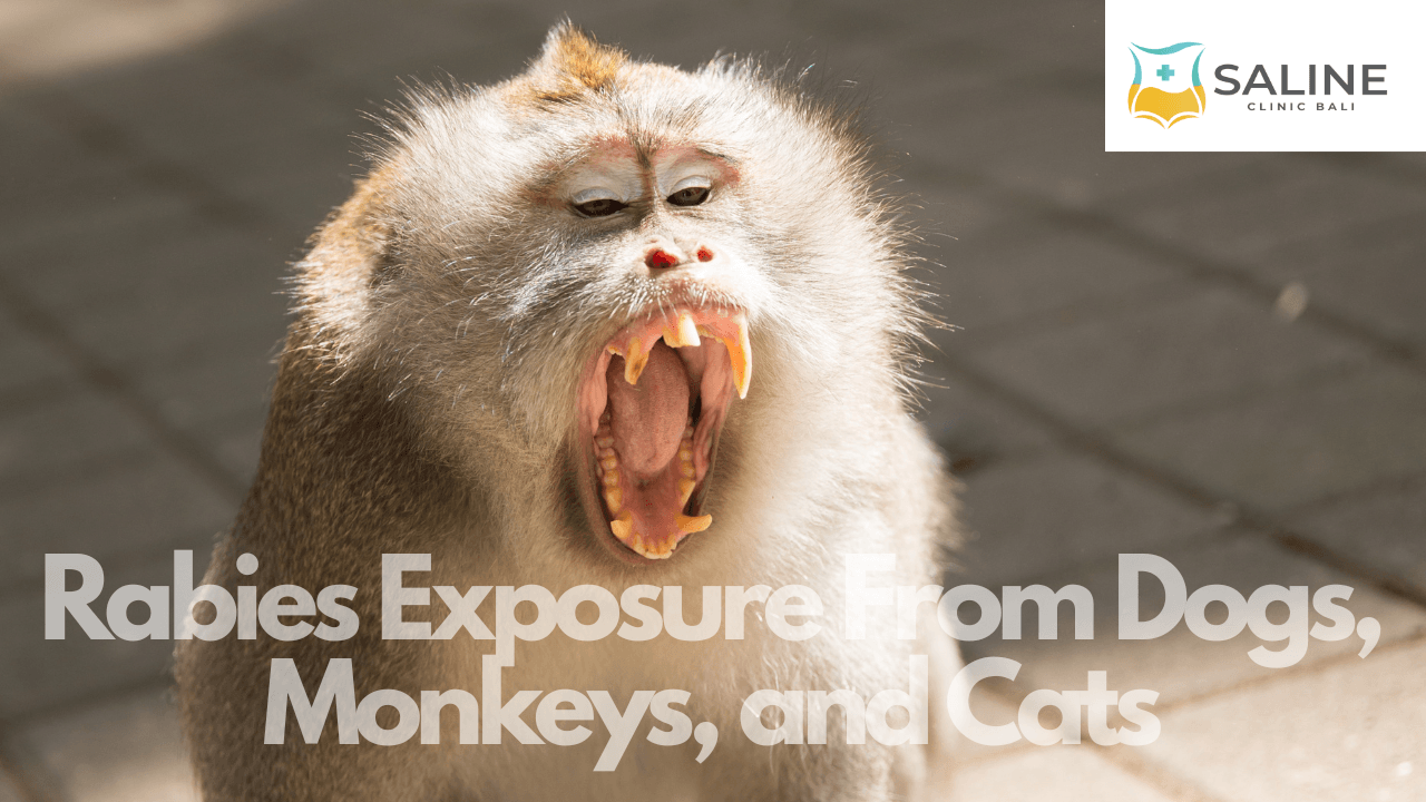 Rabies Exposure From Dogs, Monkeys, and Cats