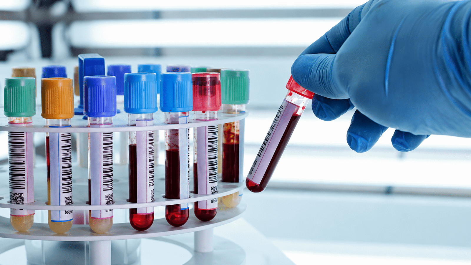 Routine Blood Work: What Needs Checking?