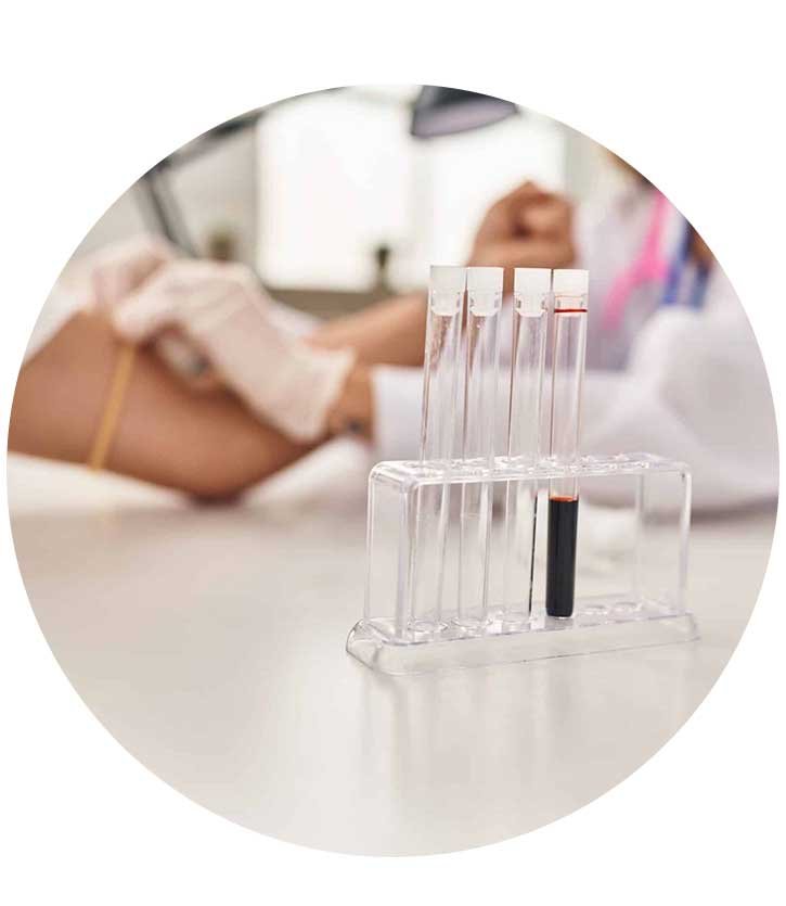 STD Testing Bali scaled 1