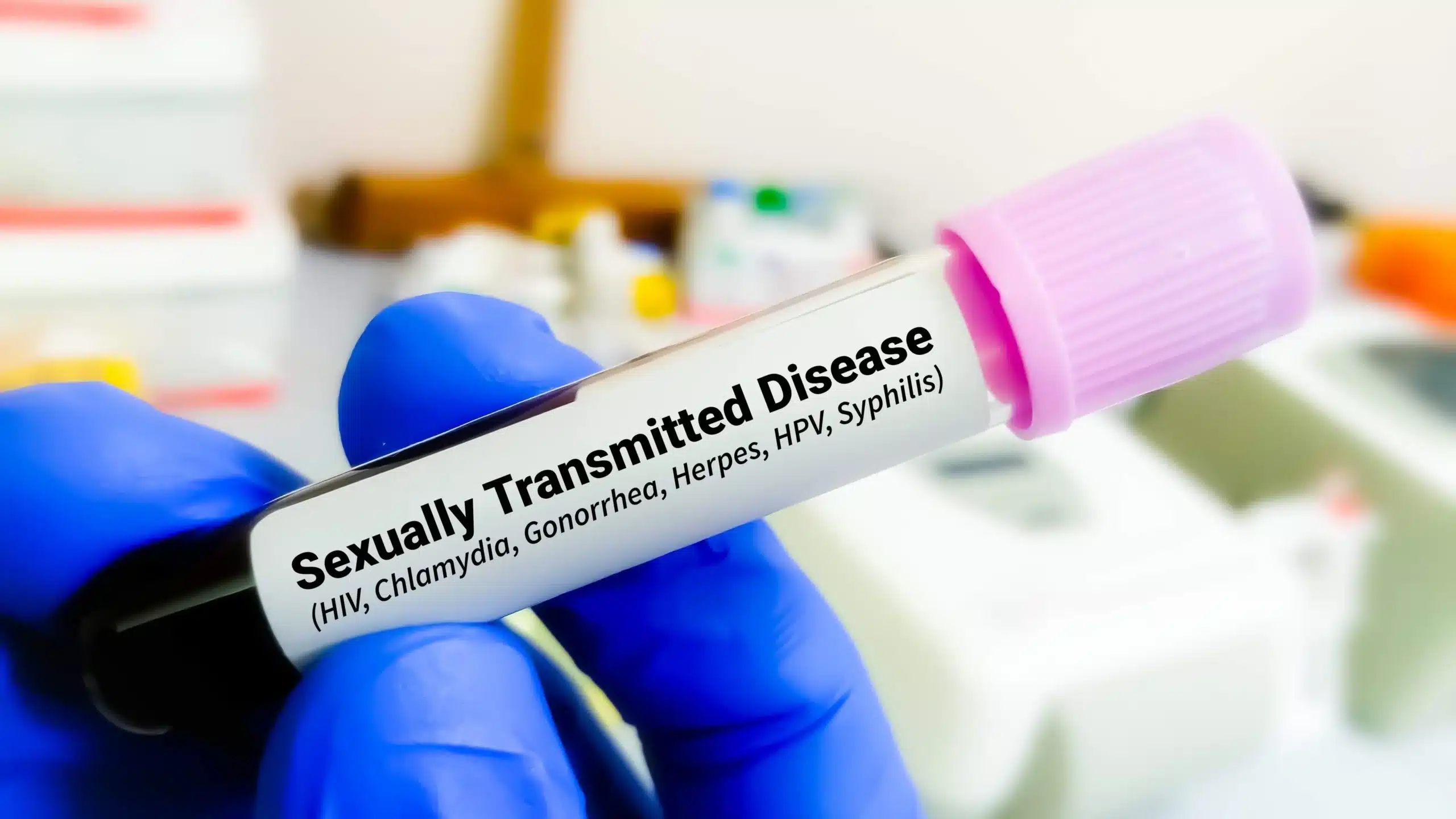 Types of STD Tests Available in Bali