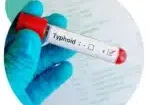typhoid-fever-test-fi